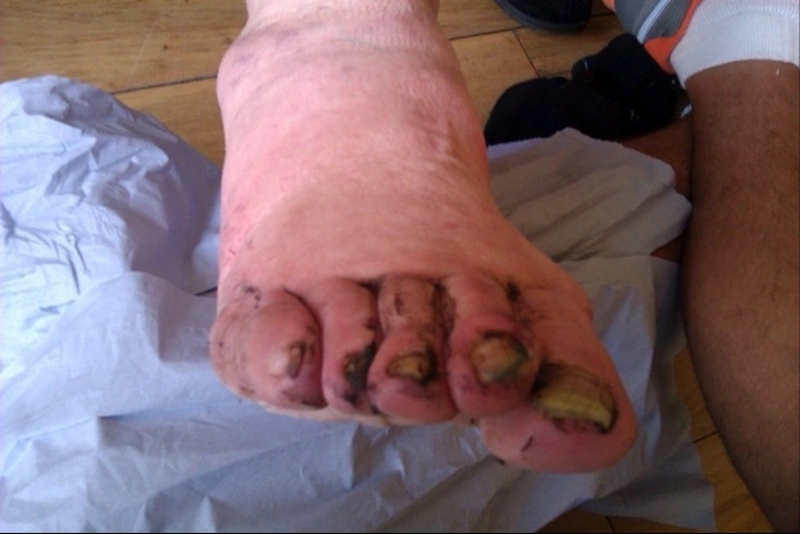 Feet of the Homeless